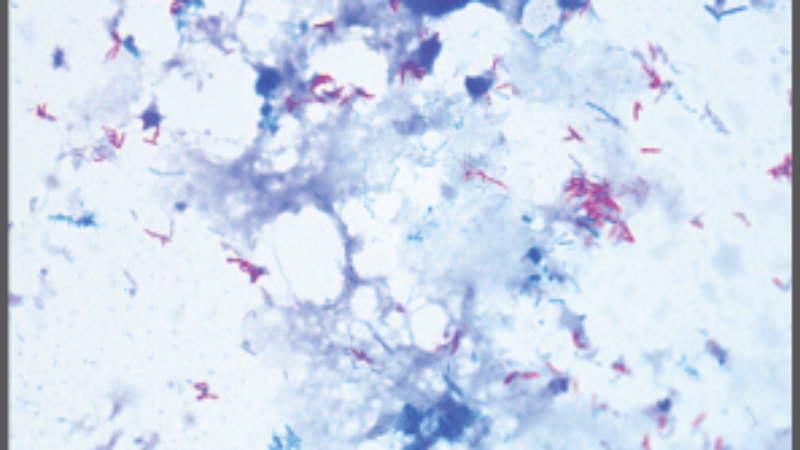 AFB-STAINS_Ziehl-Neelsen-AFB-positive-stain-100x-field-of-view