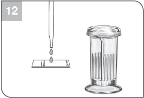 parasitology-fixative-process-step12