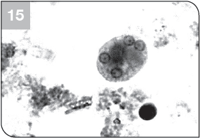 parasitology-fixative-process-step15