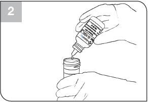 parasitology-fixative-process-step2