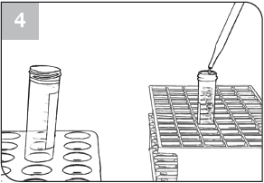 parasitology-fixative-process-step4