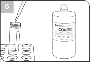 parasitology-fixative-process-step5