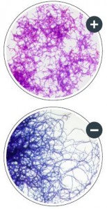 nocardia-stain-microscopy