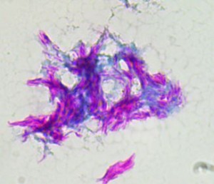 M_tuberculosis-microscopy-100x-oil-wheatlys-trichrome-stain-image