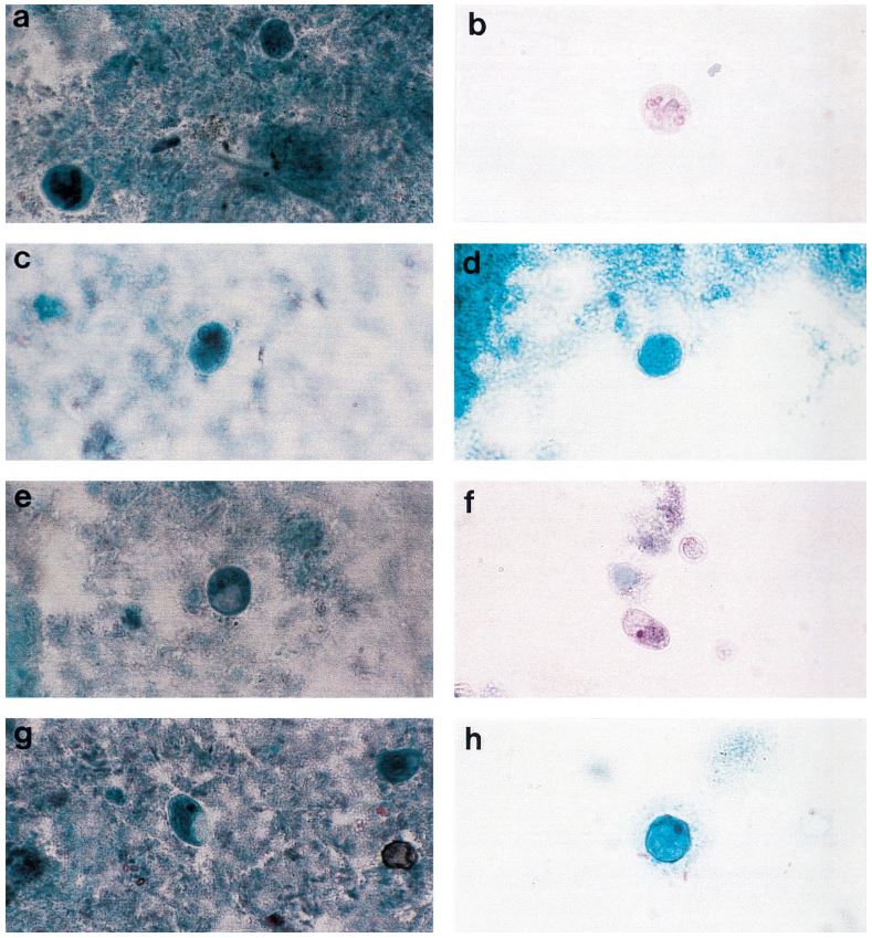 parasitology-jensen-study-fig1