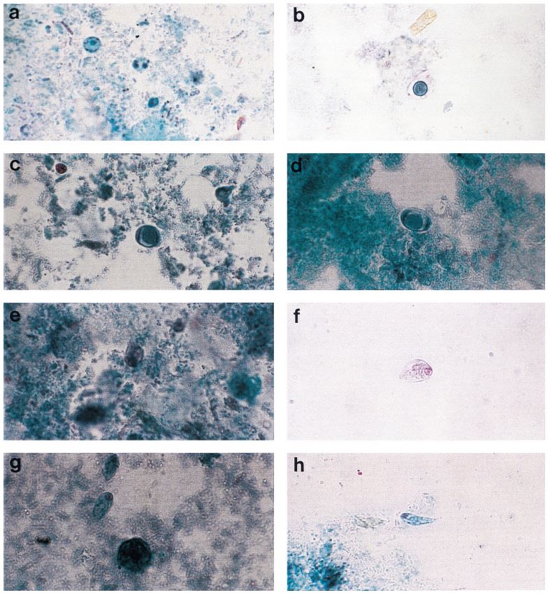 parasitology-jensen-study-fig2